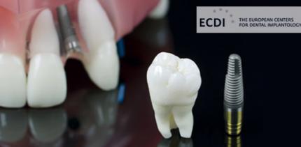 Dental implants - Sopron